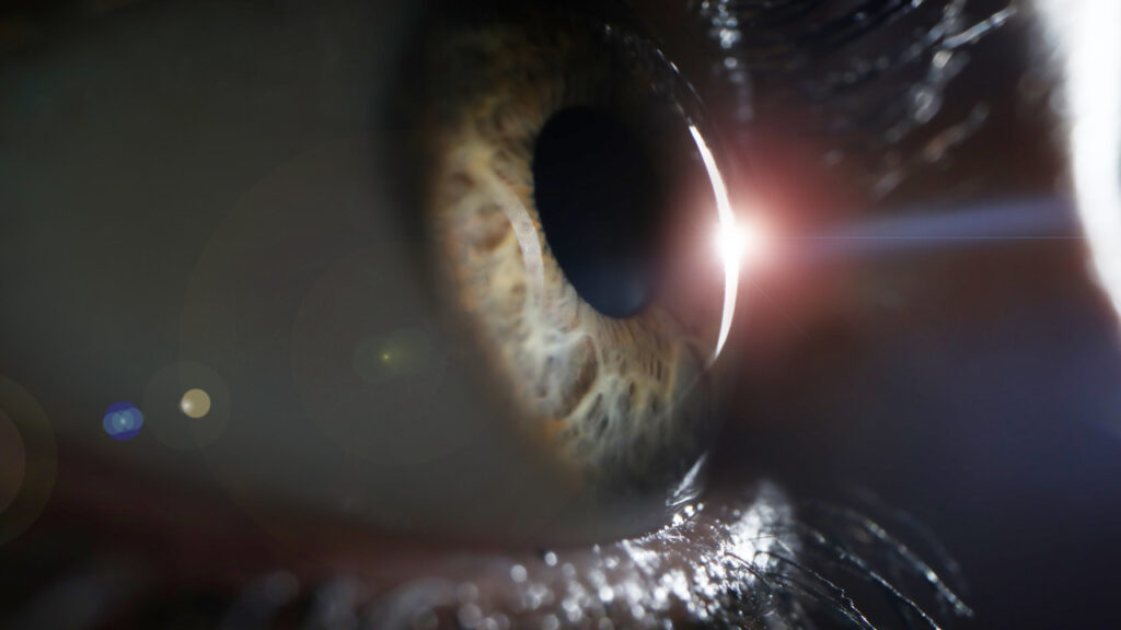 eye care