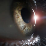 eye care