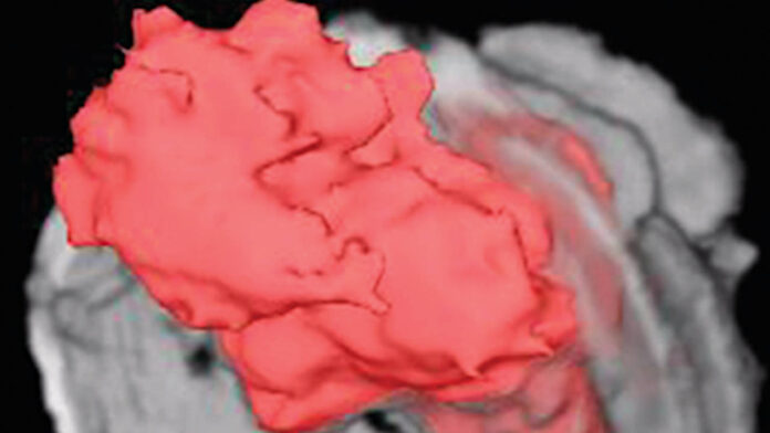 3D cystoscopy