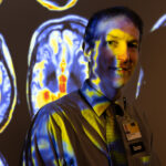 UI professor Dr. Aaron Boes studies the impact brain lesions has on addiction.