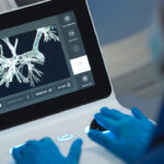Ion cancer treatment controller Mercy