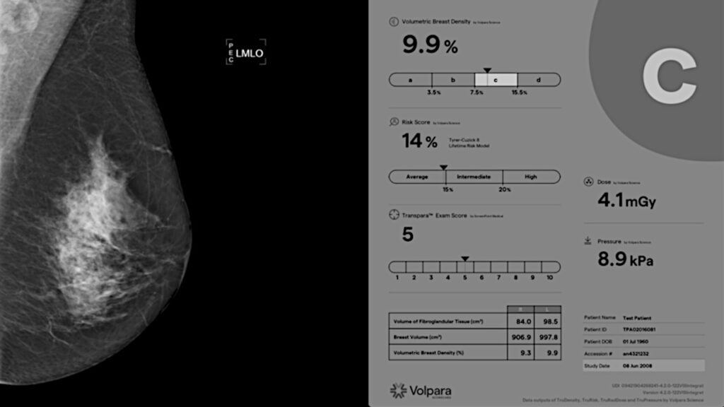 Volpara breast cancer software