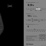 Volpara breast cancer software
