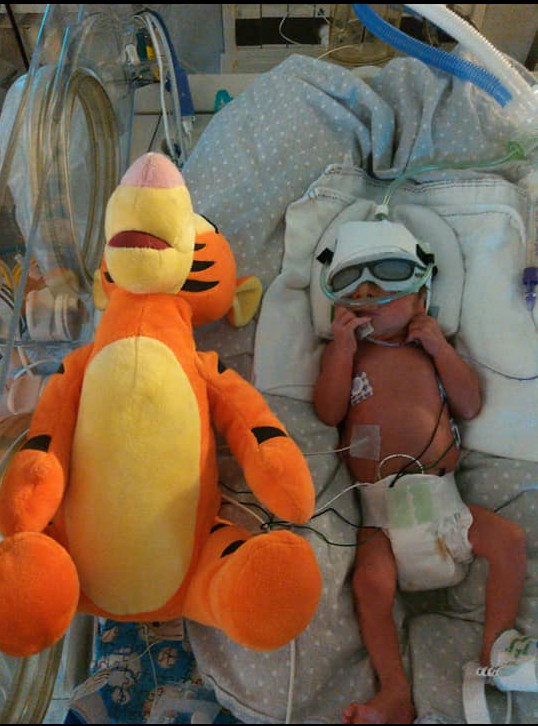 Charlie Eichhorn, today aged 8, was born at 28 weeks weighing 3 pounds, 3 ounces.